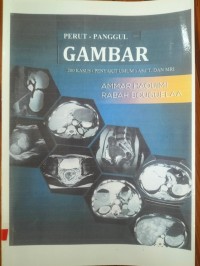 Perut-Panggul Gambar: 200 Kasus (Penyakit Umum) AS, CT, dan MRI