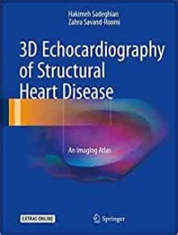 3D Echocardiography of Structural heart Diseases