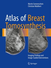 Atlas of breast Tomosynthesis