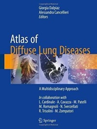 Atlas of Diffuse Lung Diseases