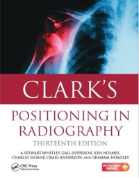 Clark's Position in radiography