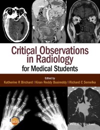 Critical Observations in Radiology