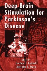 Deep Brain Stimulation for Parkinson's Disease