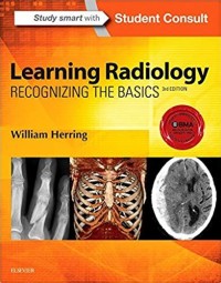 learning radiology recognizing the basics