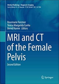 MRI and CT of The Female Pelvis