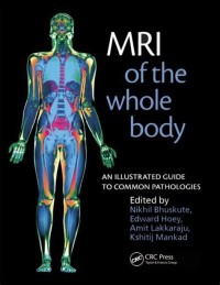 MRI OF THE WHOLE BODY