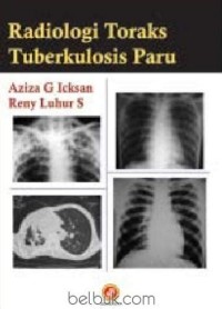 RADIOLOGI TORAKS TUBERKULOSIS PARU