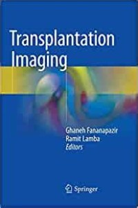 Transplation Imaging