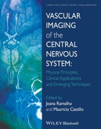 Vascular Imaging of the central nervous system