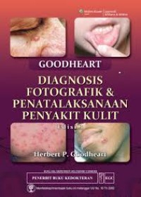 Diagnosis Fotografik & Penatalaksanaan Penyakit Kulit