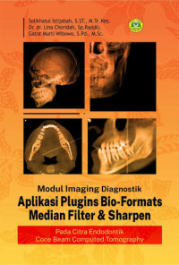 Image of Modul Imaging Diagnostik Aplikasi Plugins Bio- Formats Median Filter & Sharpen